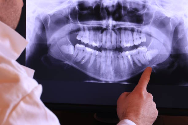 Best After-Hours Emergency Dentist in Fairview, OR