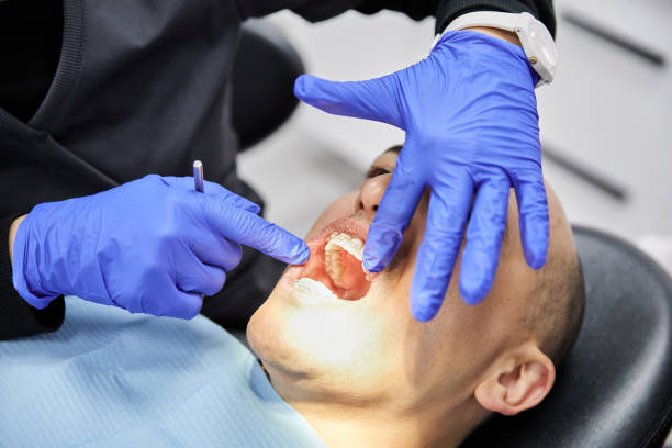 Best Emergency Dental Care for Trauma or Injury in Fairview, OR