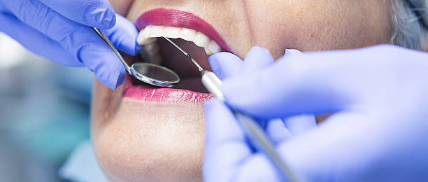 Best Emergency Tooth Extraction in Fairview, OR
